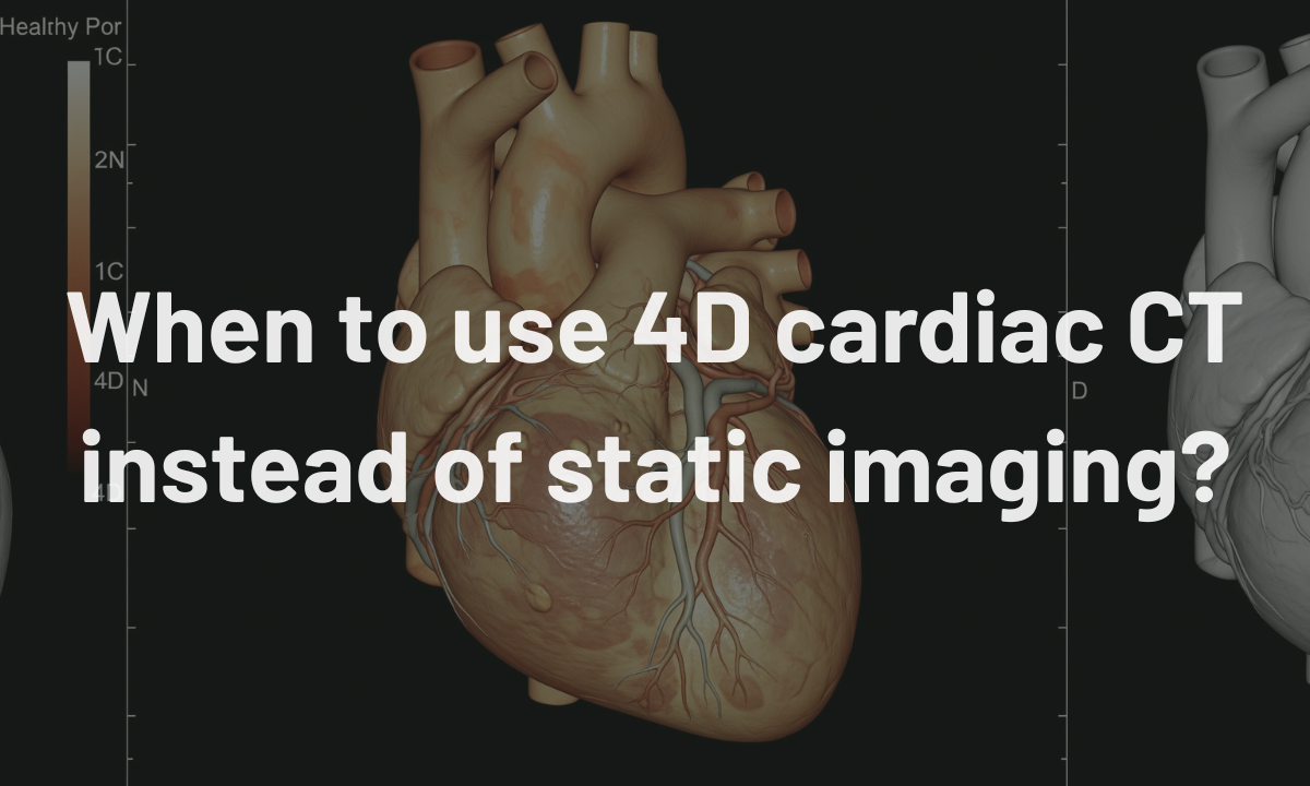 Vea Simulations